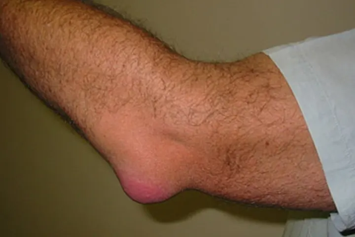 Knee-joint-pain-ayurveda-treatment-in-tamilnadu
